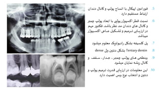 .5
‫و‬‫و‬‫ن‬‫د‬ ‫وا‬‫و‬‫ن‬‫کا‬‫و‬ ‫وپ‬‫و‬‫ل‬‫پو‬ ‫وا‬‫و‬‫س‬‫ان‬ ‫وا‬‫و‬‫ب‬ ‫وا‬‫و‬‫ک‬‫اپی‬ ‫امین‬‫ر‬‫وو‬‫و‬‫ف‬
‫دان‬
‫د‬‫ر‬‫دا‬ ‫مستقیم‬ ‫تباط‬‫ر‬‫ا‬
.6
‫و‬‫ل‬‫پو‬ ‫واد‬‫ع‬‫اب‬ ‫وا‬‫ب‬ ‫پولپی‬‫ر‬‫ژ‬‫اکسپو‬‫قطر‬ ‫نسبت‬
‫ور‬‫د‬‫یم‬ ‫پ‬
‫ود‬‫و‬‫ش‬‫با‬‫ور‬‫و‬‫ظ‬‫ن‬ ‫ود‬‫و‬‫م‬ ‫ودان‬‫و‬‫ن‬‫د‬ ‫وای‬‫و‬‫ه‬ ‫وا‬‫و‬‫ن‬‫کا‬‫و‬
.
‫وم‬‫و‬‫ه‬‫م‬ ‫ر‬‫وو‬‫و‬‫ت‬‫فن‬
‫ژ‬‫وپو‬‫و‬‫و‬‫و‬‫و‬‫و‬‫و‬‫و‬‫س‬‫اک‬ ‫وا‬‫و‬‫و‬‫و‬‫و‬‫و‬‫و‬‫و‬‫ع‬ ‫ونیل‬‫و‬‫و‬‫و‬‫و‬‫و‬‫و‬‫و‬‫ش‬‫ت‬‫و‬ ‫ورمیم‬‫و‬‫و‬‫و‬‫و‬‫و‬‫و‬‫و‬‫ت‬ ‫وابی‬‫و‬‫و‬‫و‬‫و‬‫و‬‫و‬‫و‬‫ی‬‫ز‬‫ار‬‫در‬
‫ر‬
‫میباشد‬
.7
‫میش‬ ‫معاوم‬ ‫ادیواوپو‬‫ر‬ ‫بشکل‬ ‫کاسیفه‬ ‫پل‬
‫ود‬
.8
Tertiary dentin
‫ول‬ ‫دنتین‬ ‫بشکل‬
dense
.9
‫و‬ ‫وقف‬‫و‬‫و‬‫و‬‫و‬‫و‬‫س‬ ‫ودار‬‫و‬‫و‬‫و‬‫و‬‫ج‬ ‫ور‬‫و‬‫و‬‫و‬‫و‬‫د‬‫یم‬ ‫وپ‬‫و‬‫و‬‫و‬‫و‬‫ل‬‫پو‬ ‫وای‬‫و‬‫و‬‫و‬‫و‬‫ه‬ ‫وی‬‫و‬‫و‬‫و‬‫و‬‫م‬‫بینظ‬
‫میشود‬ ‫نمایان‬ ‫یشه‬‫ر‬ ‫کانا‬
.10
‫وپ‬‫و‬‫و‬‫ل‬‫پو‬ ‫ورمیم‬‫و‬‫و‬‫ت‬ ‫ت‬‫ر‬‫ود‬‫و‬‫و‬‫ق‬ ‫وابی‬‫و‬‫و‬‫ی‬‫ز‬‫ار‬‫در‬ ‫وات‬‫و‬‫و‬‫م‬‫معاو‬ ‫وع‬‫و‬‫و‬‫ی‬‫ا‬
‫و‬
‫د‬‫ر‬‫دا‬ ‫اهمیت‬ ‫بیس‬ ‫نوع‬ ‫انتخاب‬‫و‬ ‫دنتین‬
 