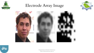 Electrode Array Image
Prepared by Dr Nazeeh Alothmany
http://nothmany.kau.edu.sa
 