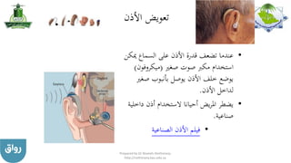 ‫األذن‬ ‫تعويض‬
•‫مي‬ ‫السماع‬ ‫على‬ ‫األذن‬ ‫قدرة‬ ‫تضعف‬ ‫عندما‬‫كن‬
‫صغري‬ ‫صوت‬ ‫مكرب‬ ‫استخدام‬(‫ميكروفون‬)
‫صغري‬ ‫بأنبوب‬ ‫يوصل‬ ‫األذن‬ ‫خلف‬ ‫يوضع‬
‫األذن‬ ‫لداخل‬.
•‫داخل‬ ‫أذن‬ ‫الستخدام‬ ‫أحيانا‬ ‫يض‬‫ر‬‫امل‬ ‫يضطر‬‫ية‬
‫صناعية‬.
•‫الصناعية‬ ‫األذن‬ ‫فيلم‬
Prepared by Dr Nazeeh Alothmany
http://nothmany.kau.edu.sa
 