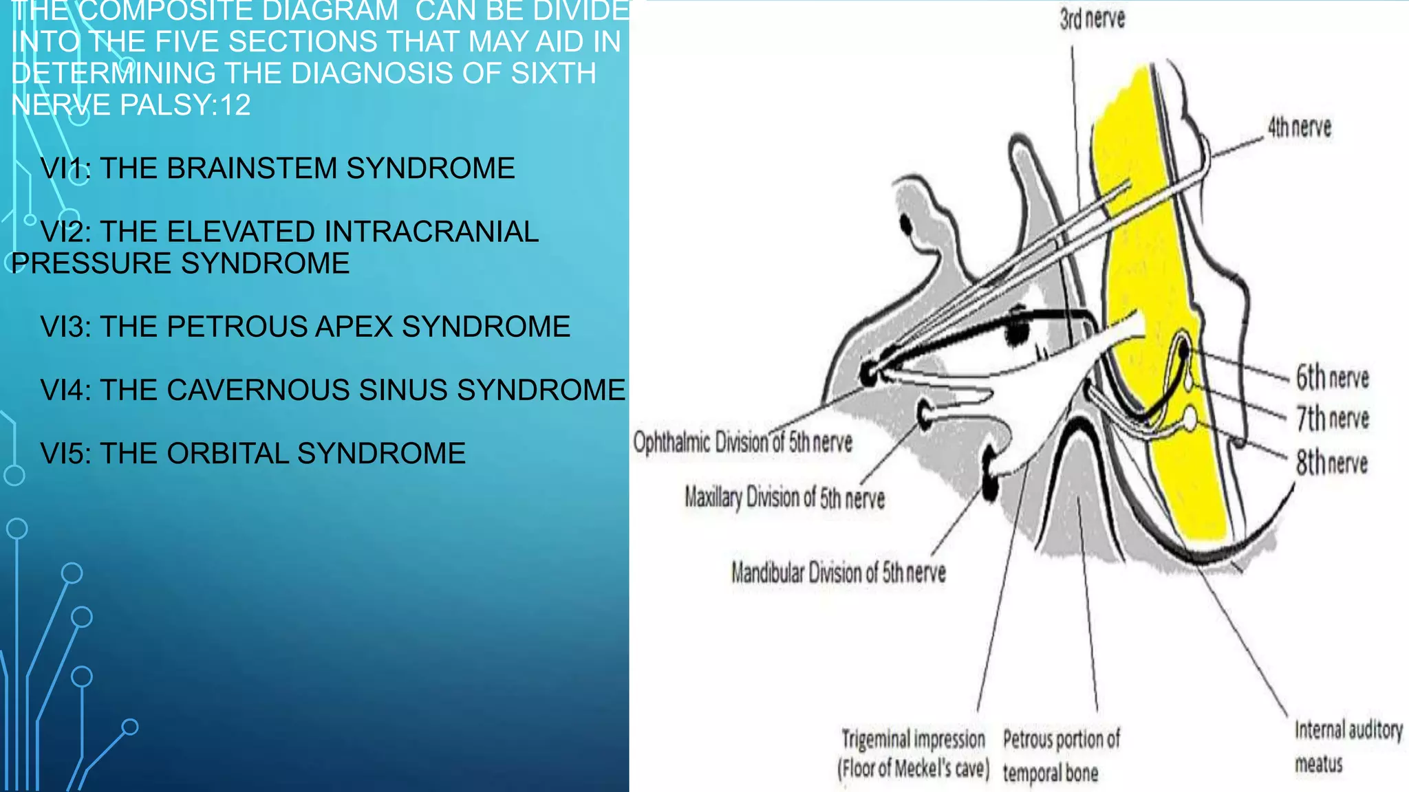 6 th nerve palsy | PPTX