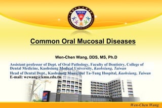Common Oral Mucosal Diseases

                         Wen-Chen Wang, DDS, MS, Ph.D
Assistant professor of Dept. of Oral Pathology, Faculty of Dentistry, College of
Dental Medicine, Kaohsiung Medical University, Kaohsiung, Taiwan
Head of Dental Dept., Kaohsiung Municipal Ta-Tung Hospital, Kaohsiung, Taiwan
E-mail: wcwang@kmu.edu.tw




                                                                    Wen-Chen Wang
 