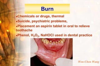 Burn
Chemicals or drugs, thermal
Suicide, psychiatric problems,

Placement an aspirin tablet in oral to relieve
toothache
Phenol, H2O2, NaHOCl used in dental practice




                                      Wen-Chen Wang
 