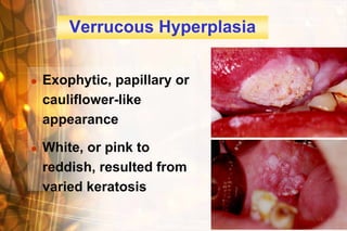 Verrucous Hyperplasia


   Exophytic, papillary or
    cauliflower-like
    appearance

   White, or pink to
    reddish, resulted from
    varied keratosis

                                Wen-Chen Wang
 