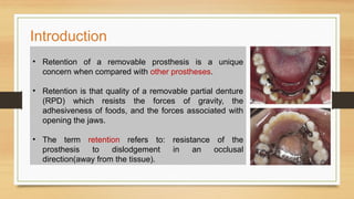 6th seminar on direct retainer.coxlyxyoxogxohxyppptx | PPTX