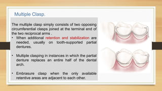 Reciprocal Tooth 6th seminar on direct retainer.coxlyxyoxogxohxyppptx | PPTX