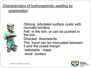 Characteristics of hydronephrotic swelling by
examination:
• Oblong lobulated surface cystic with
rounded borders.
• Felt in the loin, or can be pushed in
the loin.
• Directed downwards.
• The hand can be insinuated between
it and the costal margin
• ballotable mass
• renal contact.
hassan.ali@aswu.edu.eg
 