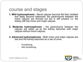 course and stages
1. Mild hydronephrosis : Renal calyces become flat then clubbed
and lately become ballooned; the parenchyma between the
minor calyces are thinned out but is still present i.e. the
kidney still has minor and major calyces.
2. Moderate hydronephrosis : the parenchyma between the
calyces are eaten up so the kidney becomes with major
calyces without minor calyces.
3. Advanced hydronephrosis : Both minor and major calyces are
lost and the kidney becomes as a sac of urine.
 Functioning.
 Non functioning.
hassan.ali@aswu.edu.eg
 