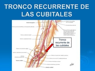 Tronco
recurrente de
las cubitales
 