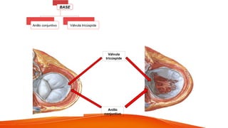 BASE
Anillo conjuntivo Válvula tricúspide
Válvula
tricúspide
Anillo
conjuntivo
 