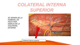 COLATERAL INTERNA
SUPERIOR
SE SEPARA DE LA
HUMERAL UN
POCO POR
DEBAJO DE LA
COLATERAL
EXTERNA
Colateral interna superior
 