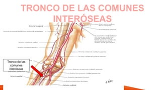 TRONCO DE LAS COMUNES
INTERÓSEAS
Tronco de las
comunes
interóseas
 