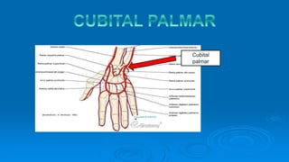 Cubital
palmar
 