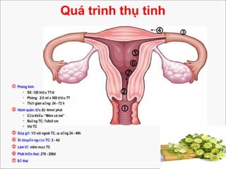 Quá trình thụ tinh




 

 Phóng tinh:
• SX: 120 tri u TT/dệ
• Phóng: 2-5 ml x 500 tri u TTệ
• Th i gian s ng: 24 - 72 hờ ố
 Hành quân: t c đ 4mm/ phútố ộ
• C a kh u: “Mõm cá mè”ử ẩ
• Bu ng TC: 7x8x5 cmồ
• Vòi TC
 G p g :ặ ỡ 1/3 vòi ngoài TC. ω s ng 24 - 48hố
 Di chuy n ng c TC:ể ượ 3 - 4d
 Làm t :ổ niêm m c TCạ
 Phát tri n thai:ể 270 - 290d
 S thaiổ
 