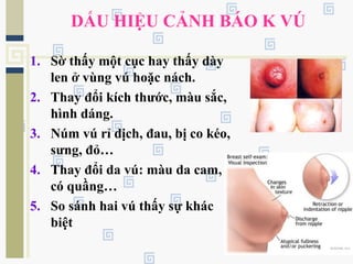 DẤU HIỆU CẢNH BÁO K VÚ
1. Sờ thấy một cục hay thấy dày
len ở vùng vú hoặc nách.
2. Thay đổi kích thước, màu sắc,
hình dáng.
3. Núm vú rỉ dịch, đau, bị co kéo,
sưng, đỏ…
4. Thay đổi da vú: màu da cam,
có quầng…
5. So sánh hai vú thấy sự khác
biệt
 