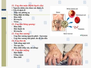 11. Ung thư máu (bệnh bạch cầu)
+ Nguyên nhân còn chưa xác định rõ.
+ Yếu tố dịch tễ:
- Tiếp xúc phóng xạ
- Sóng điện từ thấp.
- Hóa chất
- Di truyền
- Virus
12. Ung thư bàng quang:
- Hóa chất
- Hút thuốc lá
- Di truyền
13. Ung thư xương
- Ung thư xương nguyên phát : Sarcoma
- Ung thư xương thứ phát: do di căn đến
14. Ung thư da
- Ánh nắng mặt trời
- Tia cực tím
- Hóa chất (tiếp xúc, ăn uống)
15. Ung thư miệng
- Hút thuốc
- Uống rượu
- Hóa chất
 