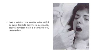 • Lave o cateter com solução salina estéril
ou água destilada estéril e se necessário,
aspire a cavidade nasal e a cavidade oral,
nesta ordem.
 