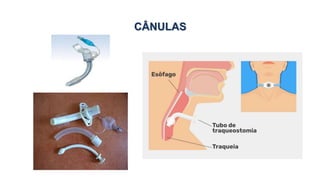 CÂNULAS
 