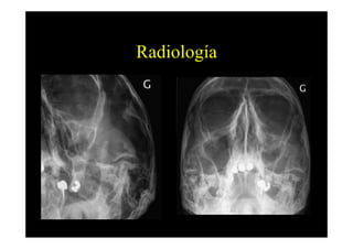 Radiología
 
