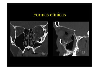 Formas clínicas
 