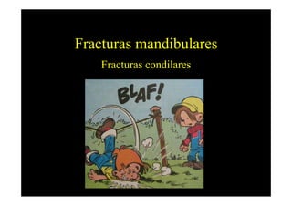 Fracturas mandibulares
    Fracturas condilares
 