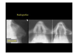 Radiografías




HN perfil
 