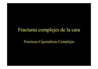 Fracturas complejes de la cara

  Fracturas Cigomáticas Complejas
 