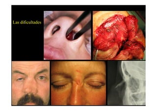 Las dificultades
 