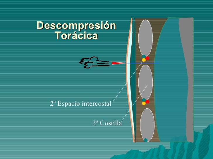 6 Trauma Toracico Trabajo Leonar