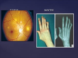 глаза костиглаза кости
 