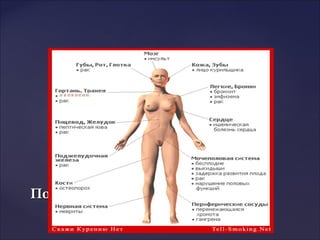 Последствия туберкулезаПоследствия туберкулеза
 