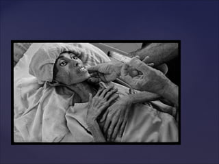 «Чахотка»«Чахотка»
 