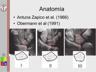 Anatomía
• Antuna Zapico et al. (1966)
• Obermann et al (1991)
 