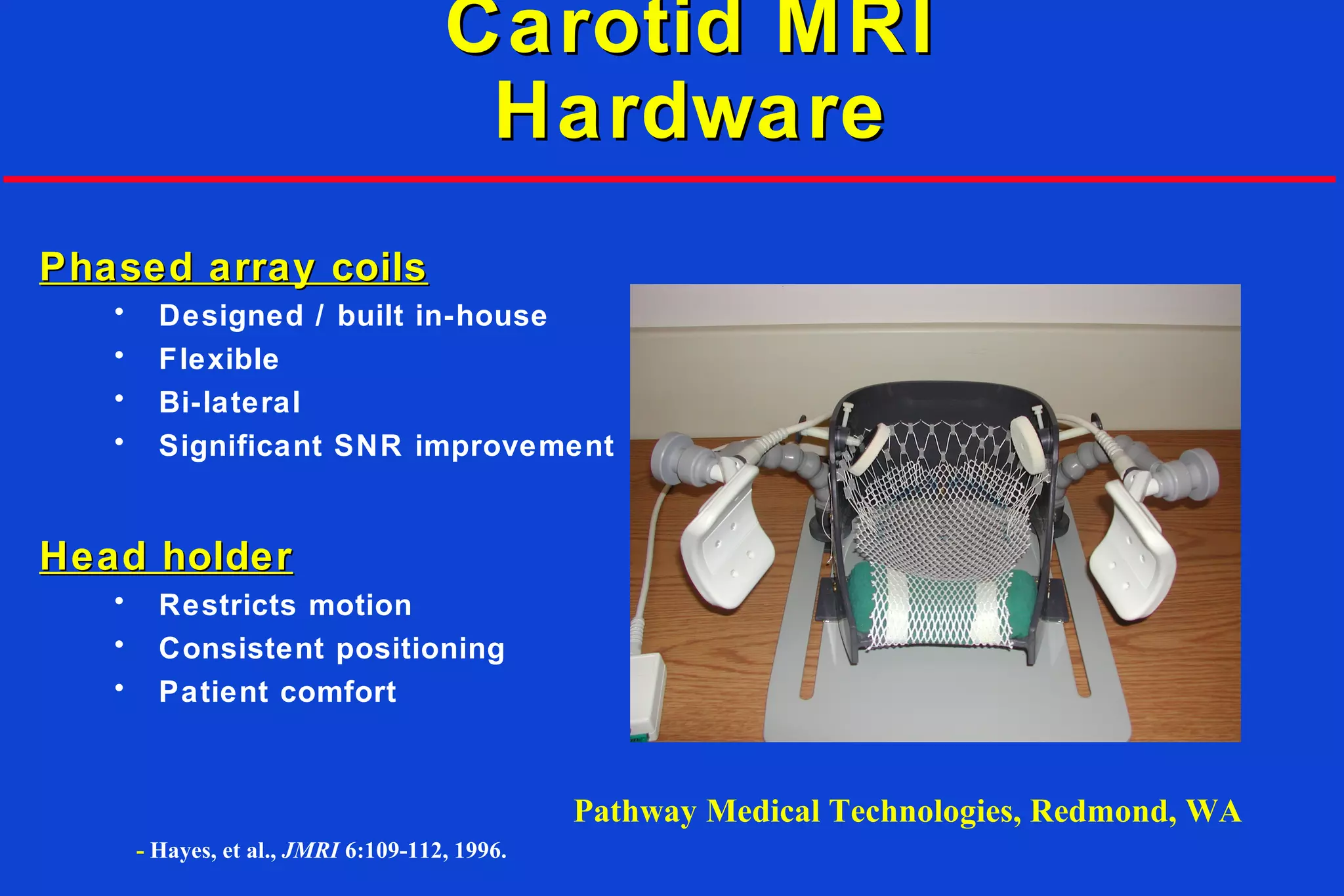 Carotid MRICarotid MRI
HardwareHardware
Phased array coilsPhased array coils
• Designed / built in-house
• Flexible
• Bi-lateral
• Significant SNR improvement
Head holderHead holder
• Restricts motion
• Consistent positioning
• Patient comfort
- Hayes, et al., JMRI 6:109-112, 1996.
Pathway Medical Technologies, Redmond, WA
 