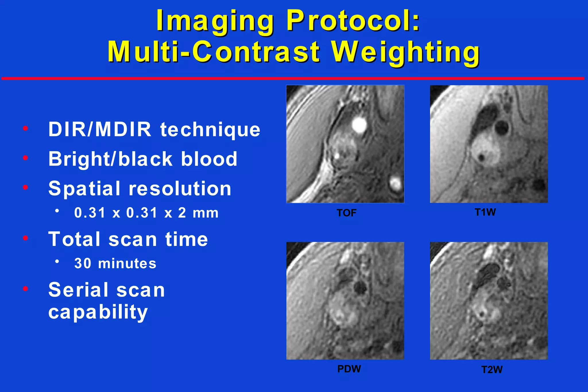 Imaging Protocol:Imaging Protocol:
Multi-Contrast WeightingMulti-Contrast Weighting
• DIR/MDIR technique
• Bright/black blood
• Spatial resolution
• 0.31 x 0.31 x 2 mm
• Total scan time
• 30 minutes
• Serial scan
capability
TOF T1W
PDW T2W
 