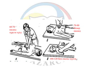 60-70 
насанд 
хүрсэн хүнд 
70-80 
Өсвөр 
насанд 
100-120 бага насны хүүхэд 
 