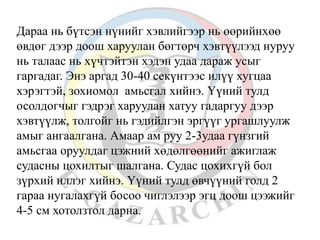 Дараа нь бүтсэн нүнийг хэвлийгээр нь өөрийнхөө 
өвдөг дээр доош харуулан бөгтөрч хэвтүүлээд нуруу 
нь талаас нь хүчтэйтэн хэдэн удаа дараж усыг 
гаргадаг. Энэ аргад 30-40 секүнтээс илүү хугцаа 
хэрэгтэй, зохиомол амьсгал хийнэ. Үүний тулд 
осолдогчыг гэдрэг харуулан хатуу гадаргуу дээр 
хэвтүүлж, толгойг нь гэдийлгэн эргүүг ургашлуулж 
амыг ангаалгана. Амаар ам руу 2-3удаа гүнзгий 
амьсгаа оруулдаг цэжний хөдөлгөөнийг ажиглаж 
судасны цохилтыг шалгана. Судас цохихгүй бол 
зүрхий иллэг хийнэ. Үүний тулд өвчүүний голд 2 
гараа нугалахгүй босоо чиглэлээр эгц доош цээжийг 
4-5 см хотолзтол дарна. 
 