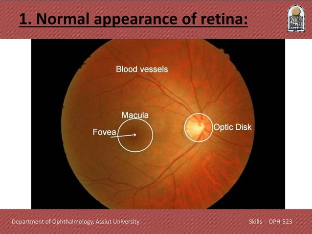 Retina Problems Skills in Retinal disease diagnosis.pptx
