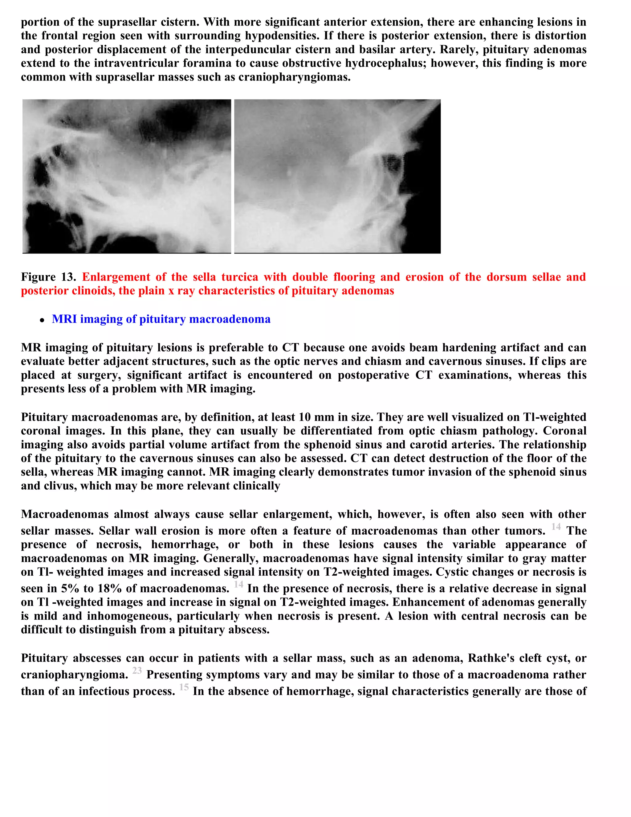 Topic of the month...Neuroimaging of pituitary adenomas
