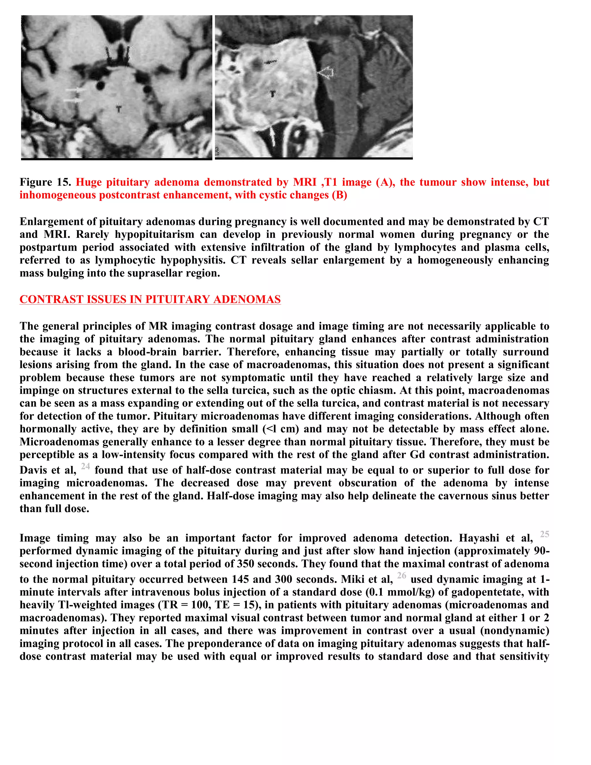 Topic of the month...Neuroimaging of pituitary adenomas