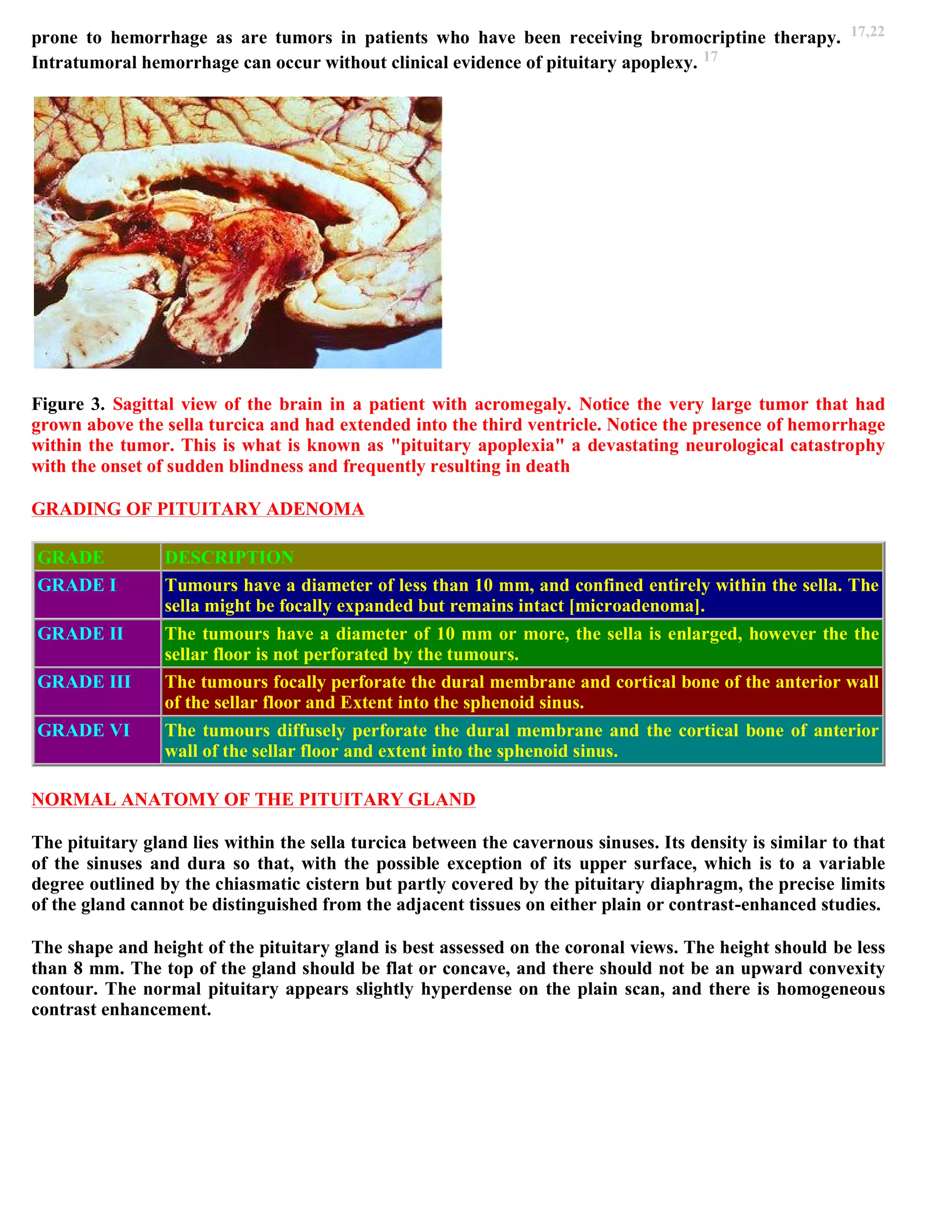 Topic of the month...Neuroimaging of pituitary adenomas