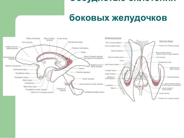 желудочки мозга картинки схемы онлайн желудочки мозга картинки схемы