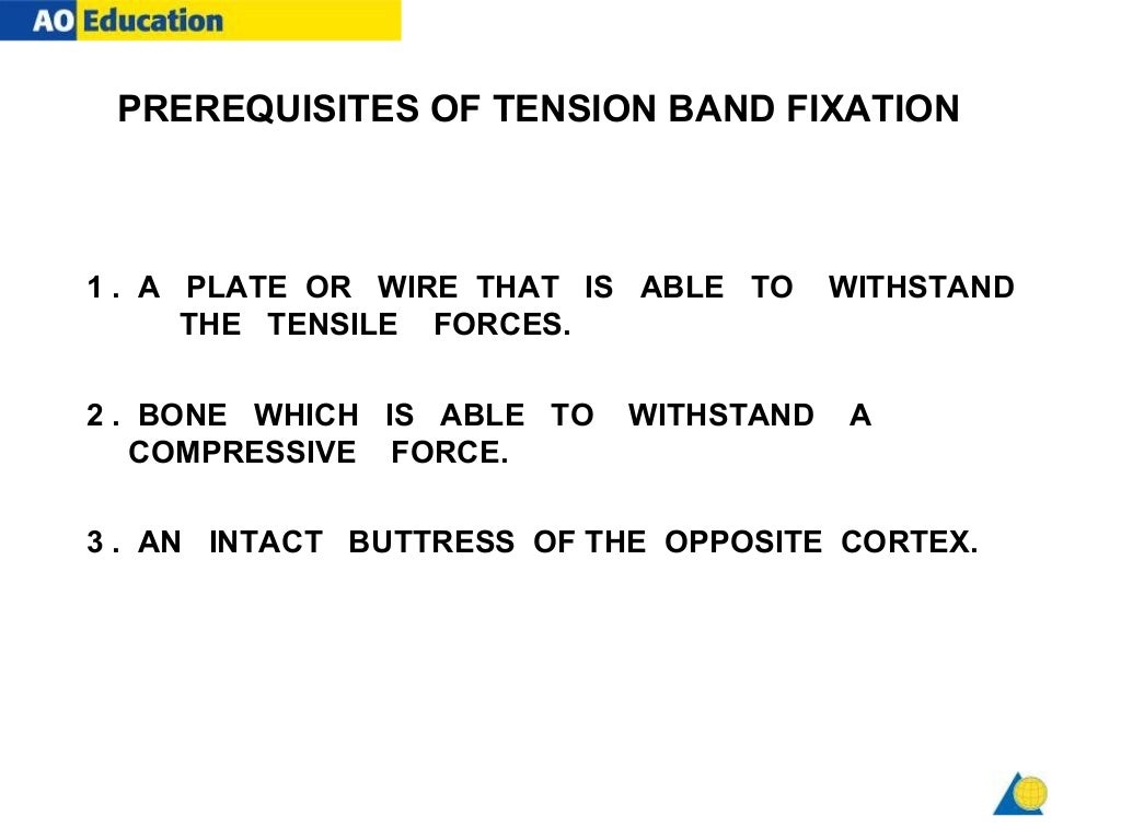 tension band wiring