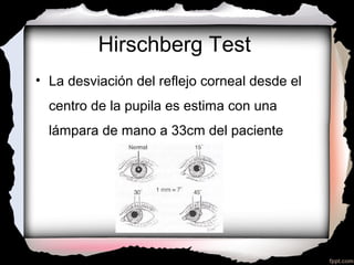 Hirschberg Test Normal 7. diagnostico cuantitativo en estrabismo | PPT