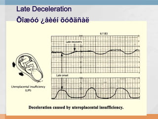 Late Deceleration
Õîæóó ¿åèéí õóðäñàë

 