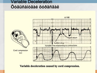 Variable Deceleration
Õóâüñàìòãàé õóðäñãàë

 