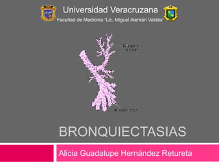 Universidad Veracruzana
Facultad de Medicina “Lic. Miguel Alemán Valdés”

BRONQUIECTASIAS
Alicia Guadalupe Hernández Retureta

 