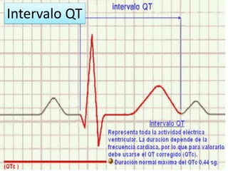 Intervalo QT

 