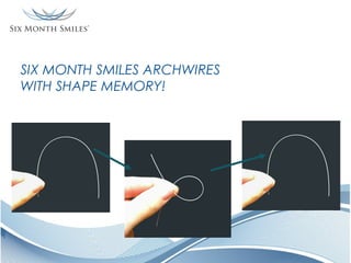 SIX MONTH SMILES ARCHWIRES
WITH SHAPE MEMORY!

 