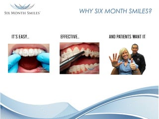 WHY SIX MONTH SMILES?

 