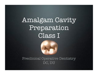 Amalgam Cavity
Preparation
Class I
Preclinical Operative Dentistry
DC, DU

 